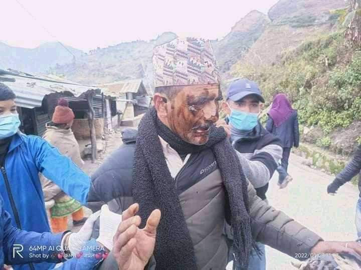 विप्लवनिकट विद्यार्थीद्वारा बझाङमा वडाध्यक्ष र सचिवलाई कालोमोसो