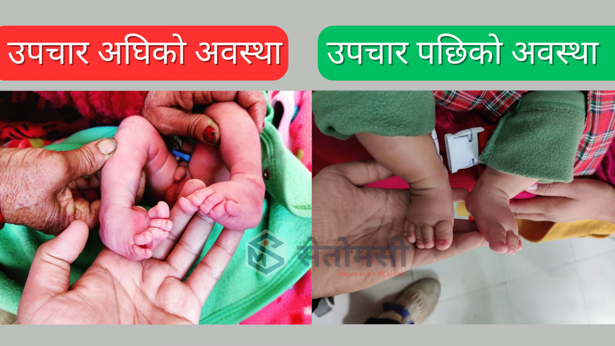 रेसुङ्गा नगरपालिकाको मेयरमा नेपाली कांग्रेसका खिलध्वज पन्थी विजयी